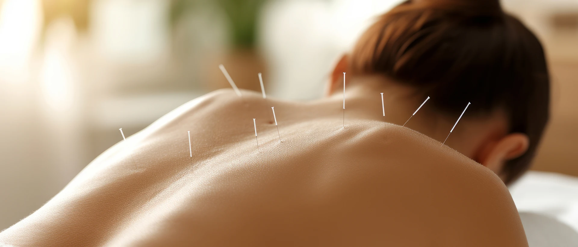 Acupuncture For Addiction